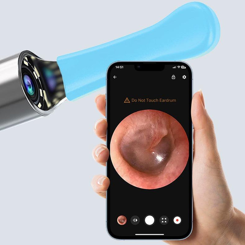 Silicone Ear Hygiene Set, HD Visual Earwax Removal Tool with Camera, 1296P HD Camera Ear Cleaner, Compatible with Iphone and Android Phones, Springtok, Spring Gift Set