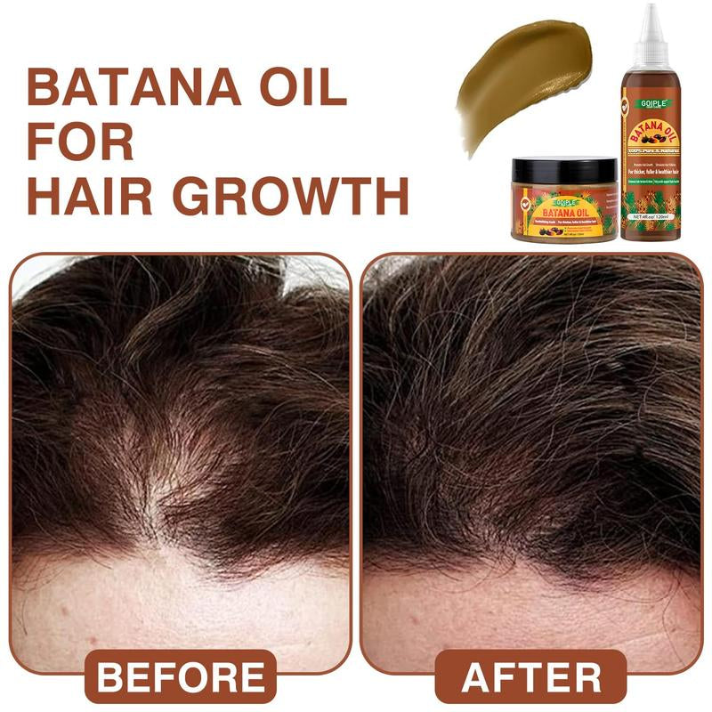 【Spring Glow-Up】Natural Batana Oil for Hair Growth - Pure Organic Hair Oil for Strengthening and Thickening, Raw Batana Oil for Healthy Hair (2 Pack)
